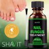 ANTI FUNGAL TREATMENT EXTRA STRENGTH TOENAIL FUNGUS ATHLETES FOOT FUNGI NAIL